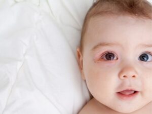 Ensuring Proper Newborn Head Position in a Car Seat: A Parent’s Essential Guide