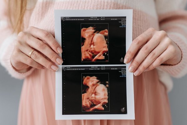 twin pregnancy what to expect